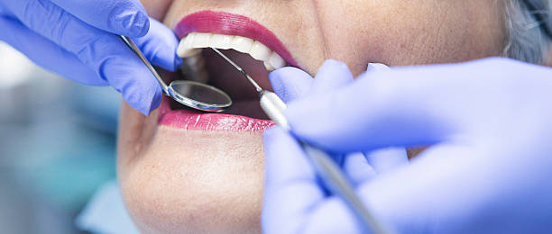 Best Emergency Wisdom Tooth Extraction in Wiggins, MS